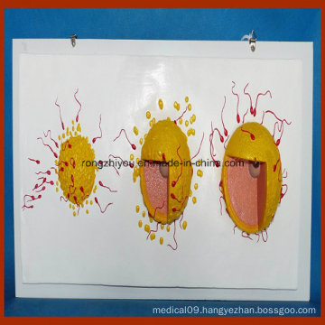 Hanging Human Sexual Intercourse (sperm and egg combine) Demonstrating Model